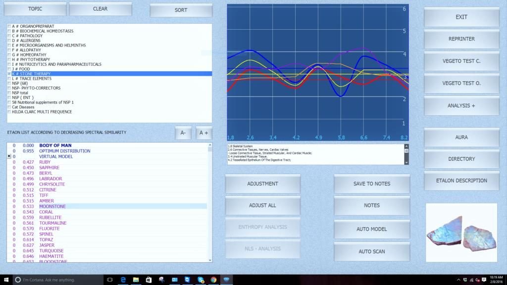 biorezonans nls 17d