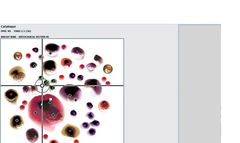 Biorezonans NLS 18D HUNTER 4025 – Najlepsze Zalety006
