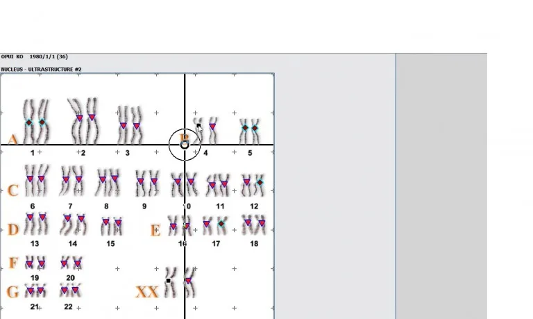 Biorezonans NLS 18D HUNTER 4025 – Najlepsze Zalety009
