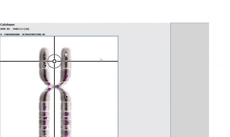 Biorezonans NLS 18D HUNTER 4025 – Najlepsze Zalety011