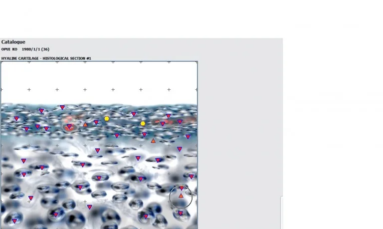 Biorezonans NLS 18D HUNTER 4025 – Najlepsze Zalety017