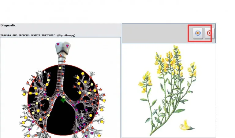 Biorezonans NLS HUNTER 4025 – Zastosowanie fitoterapii005