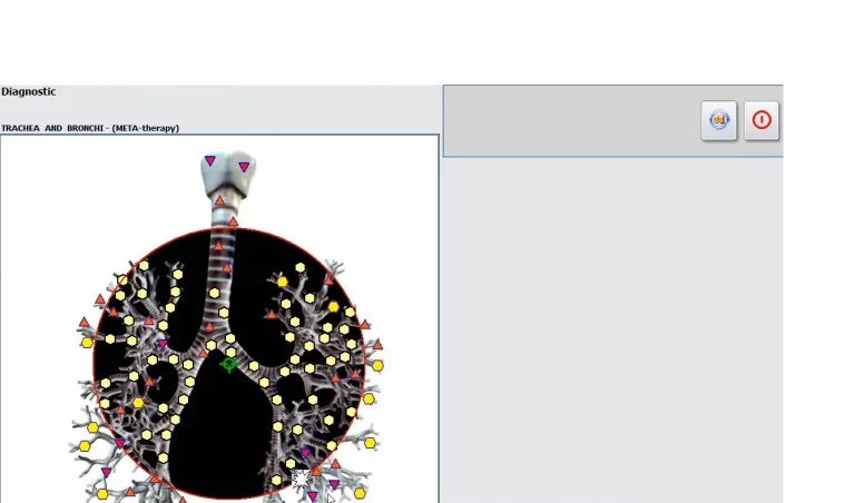 Jak uzywac funkcji Problem Meta Therapy w Biorezonansie NLS 4025 25D005