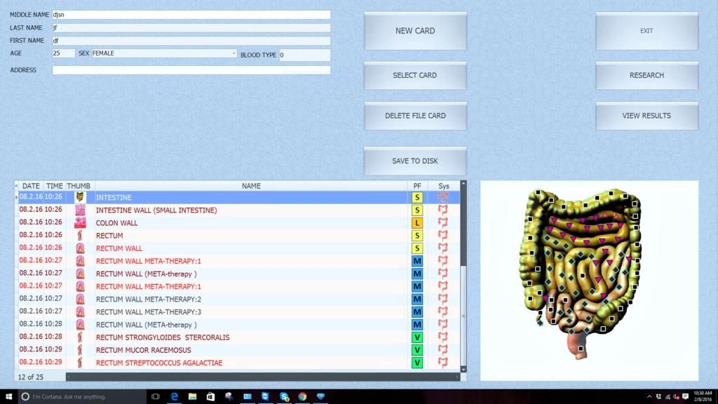 Biorezonans 8D NLS