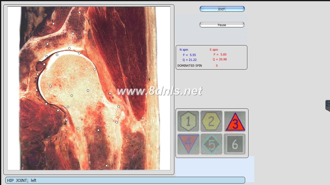 Biorezonans 8D NLS