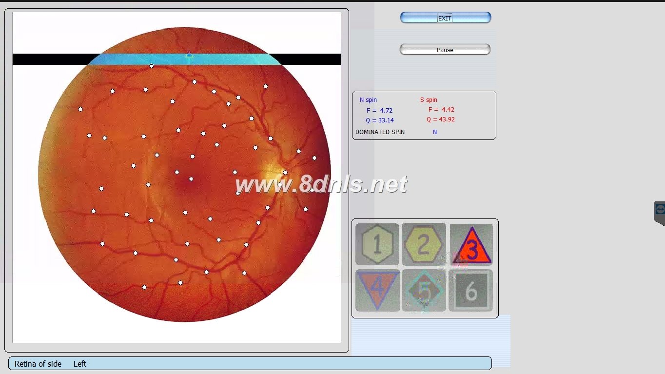 Biorezonans 8D NLS
