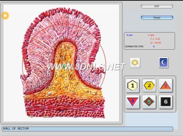 Biorezonans NLS w stomatologii - Rewolucyjne podejście do diagnostyki 8 Biorezonans NLS