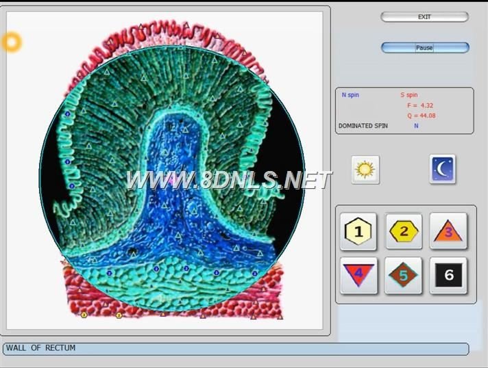 Biorezonans NLS w stomatologii - Rewolucyjne podejście do diagnostyki 7 Biorezonans NLS