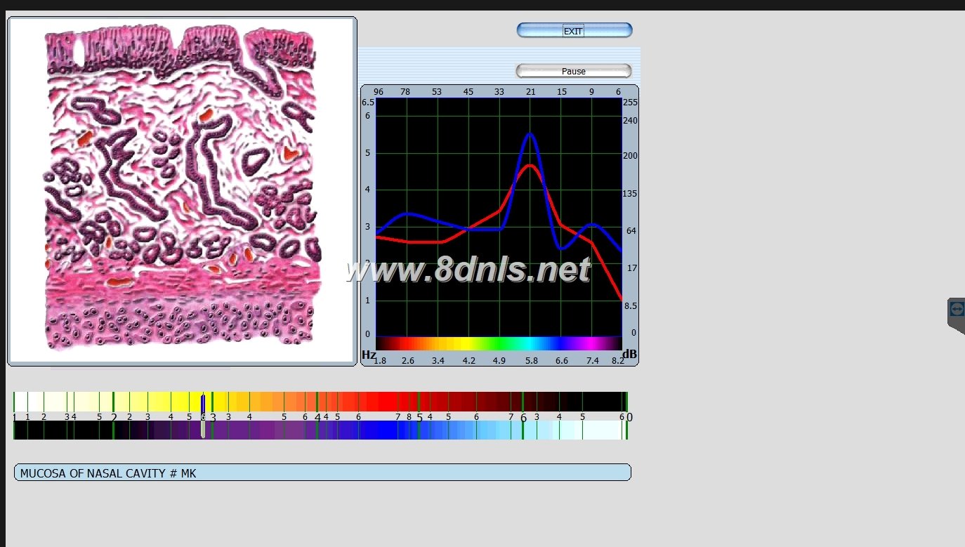 Biorezonans 8D NLS