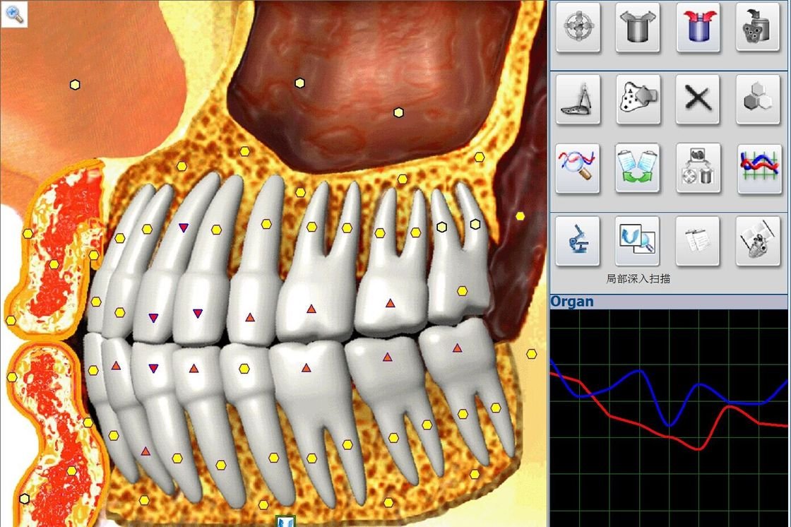 biorezonansu NLS 10