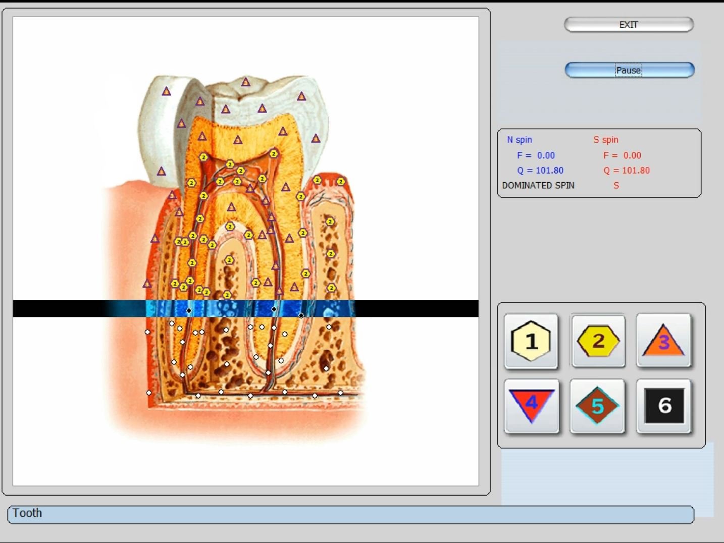 Biorezonans 8D NLS