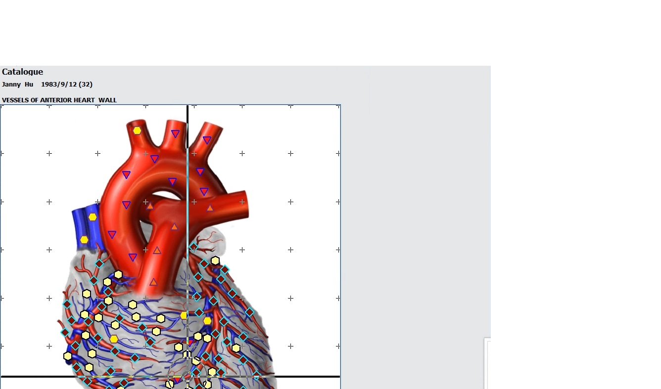 MAIKONG Hunter 4025 Metatron software
