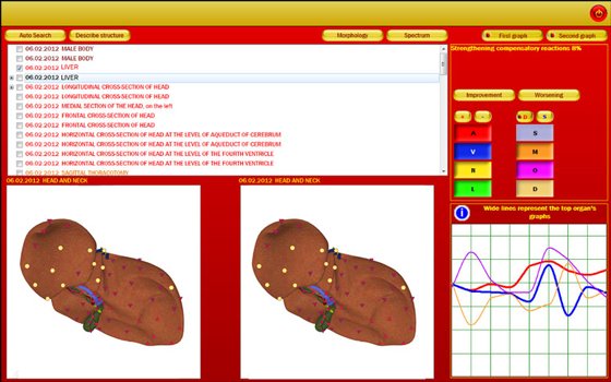 metatron 4025 red software
