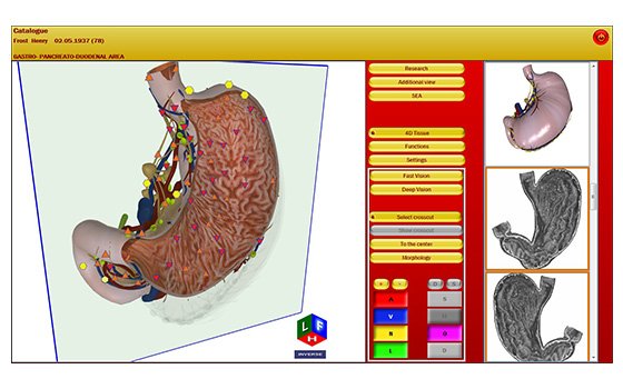 metatron 4025 red software
