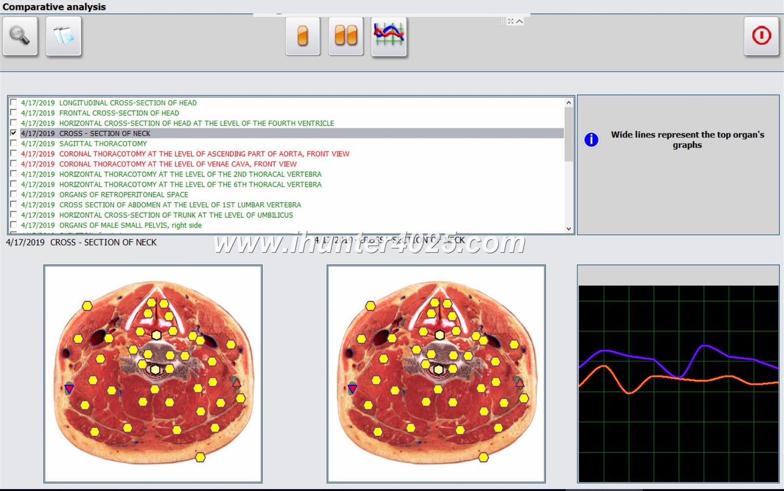 Biorezonans Badania NLS