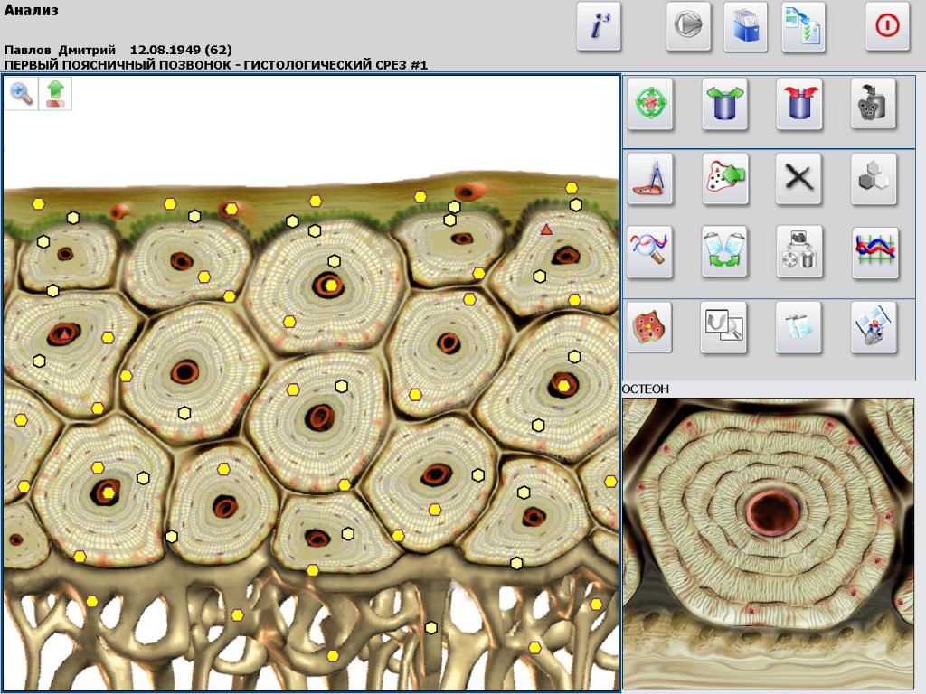 MAIKONG Hunter 4025 Metatron software