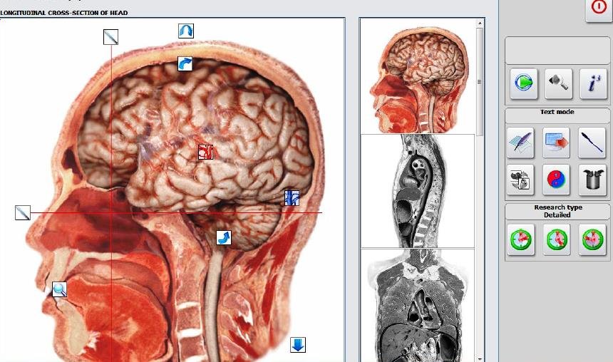 Biorezonans NLS urządzenie diagnostyczne do wykrywania boreliozy