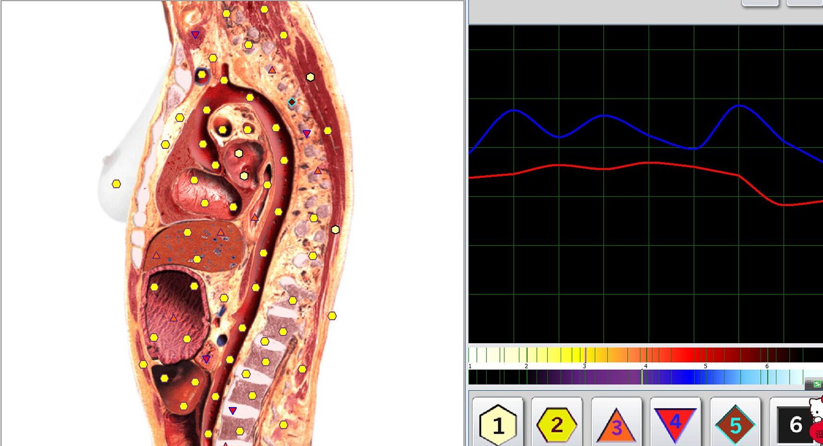 Biorezonans Metatron