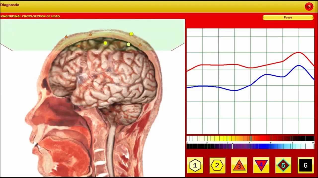 Biorezonans Odczulanie