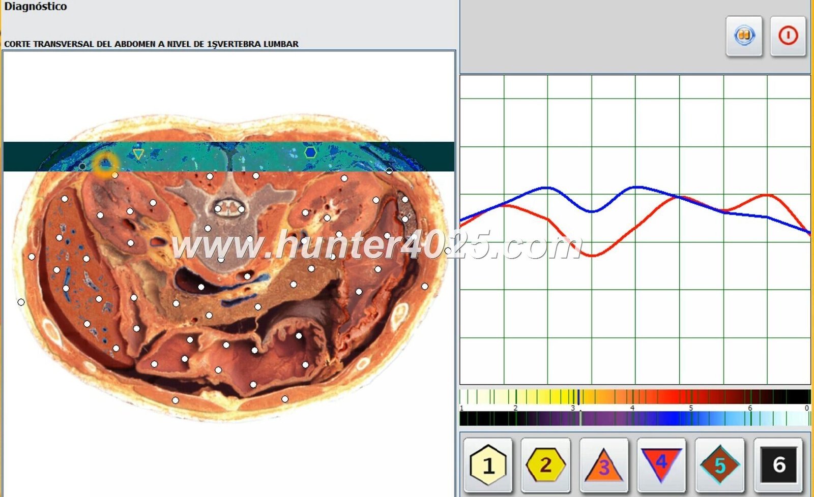 Urządzenie do biorezonansu