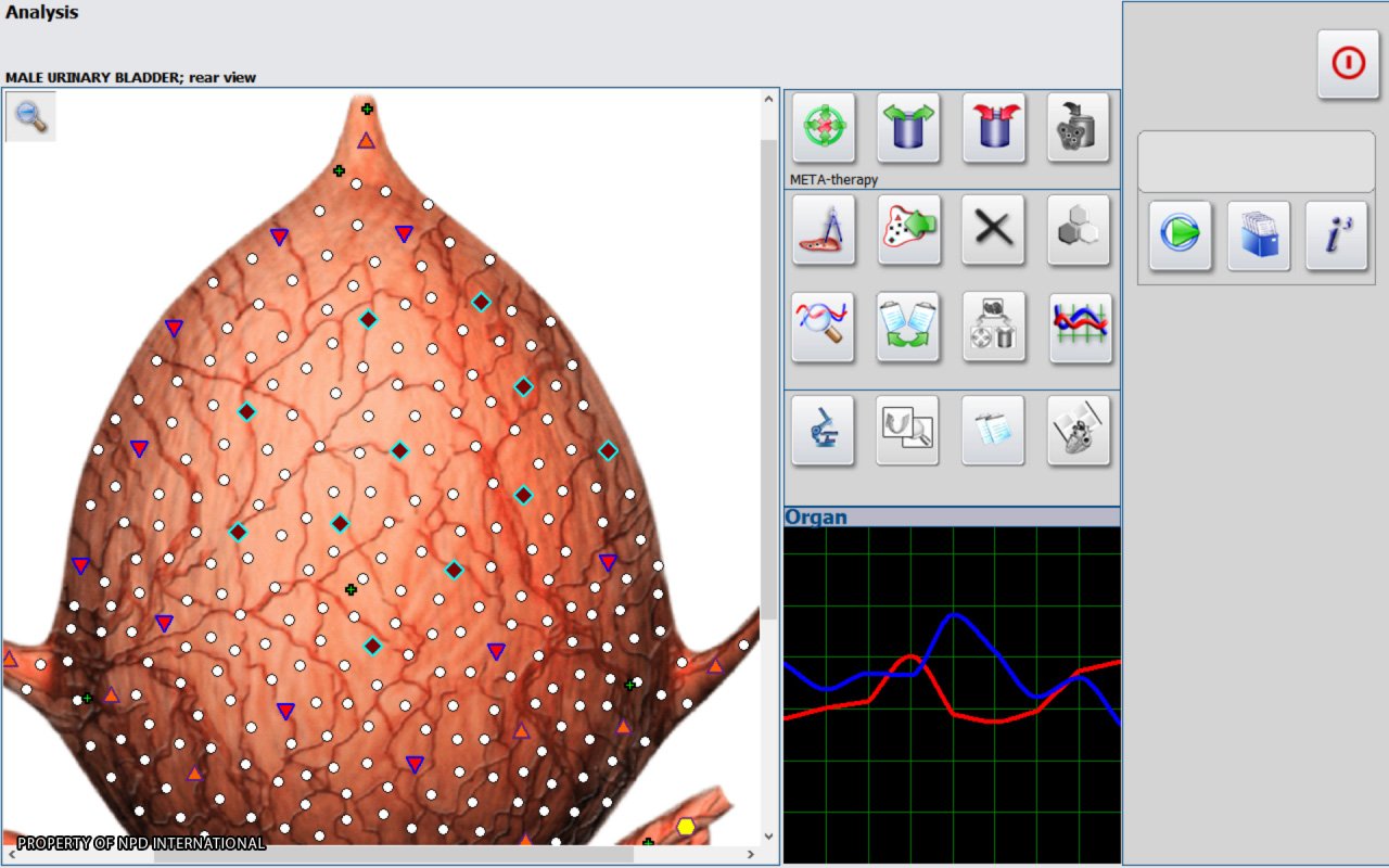 Urządzenie do biorezonansu