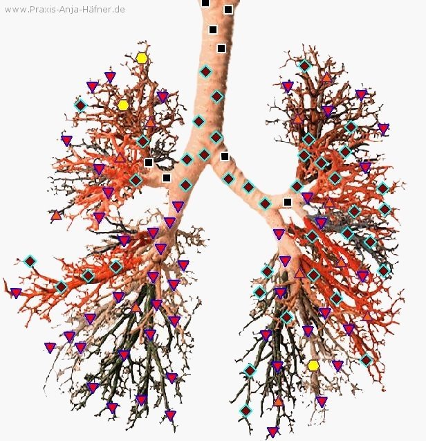 MAIKONG Hunter 4025 Metatron (733)