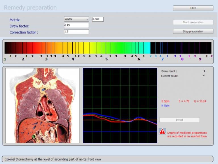 Nieliniowa Diagnostyka NLS
