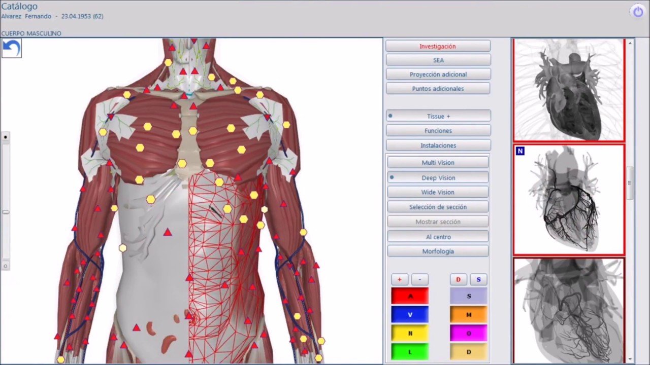 metatron 4025 red software