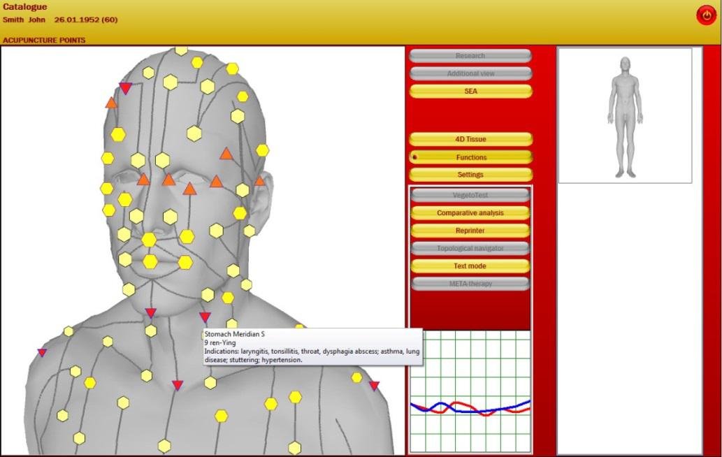 metatron 4025 red software