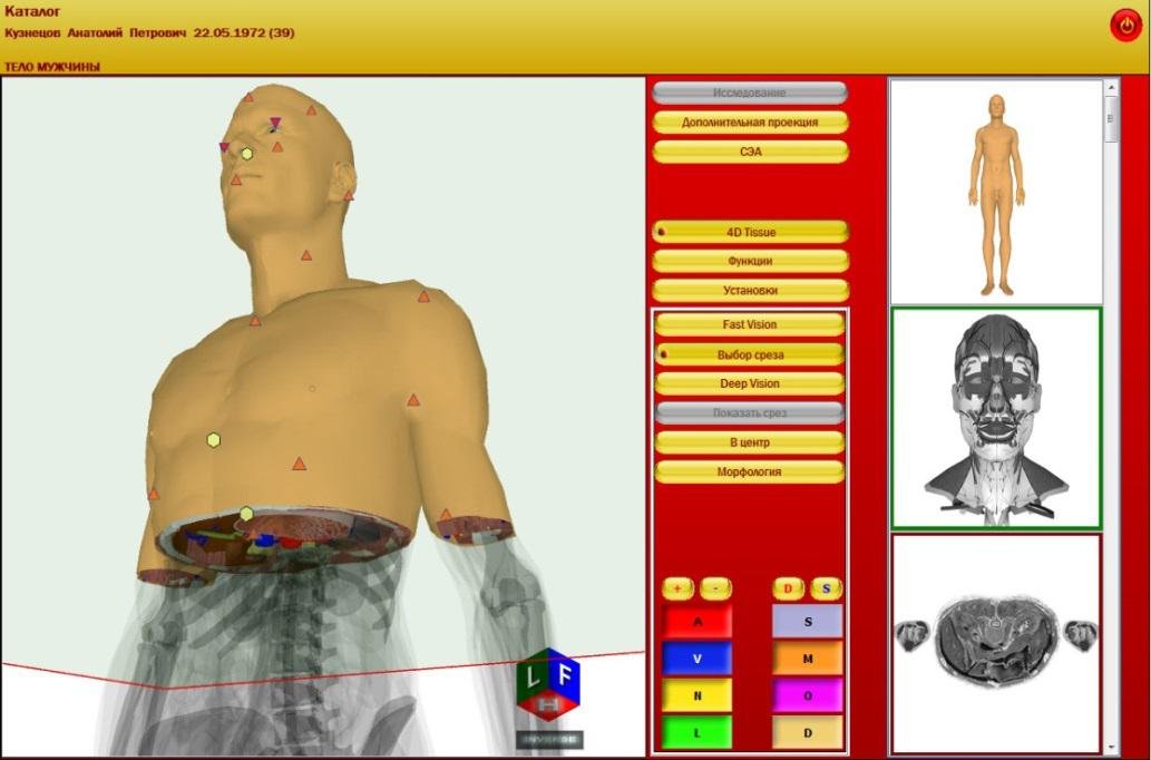 metatron 4025 red software