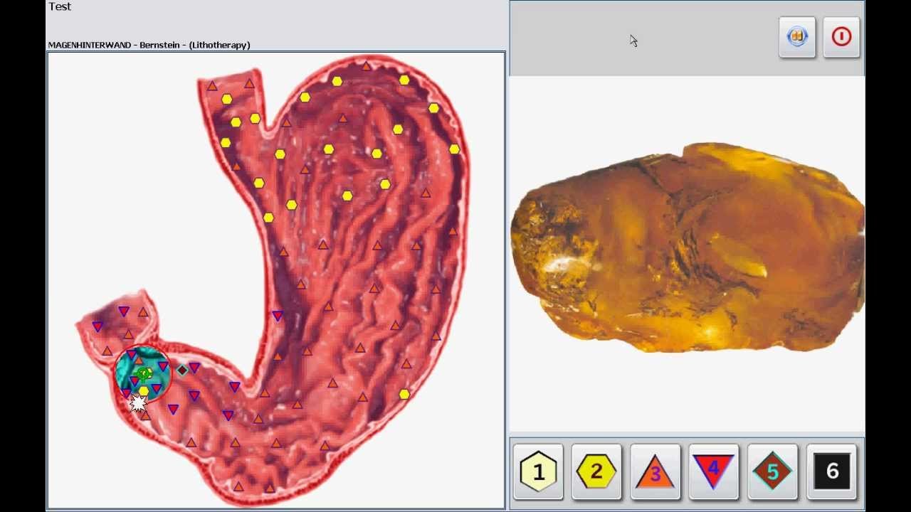 Urządzenie Biorezonans Metatron 4025 NLS