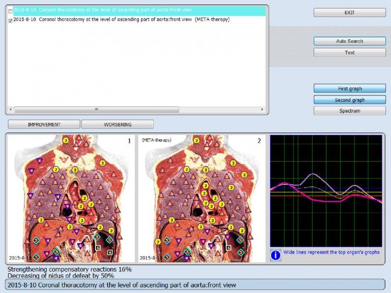 Nieliniowa Diagnostyka NLS