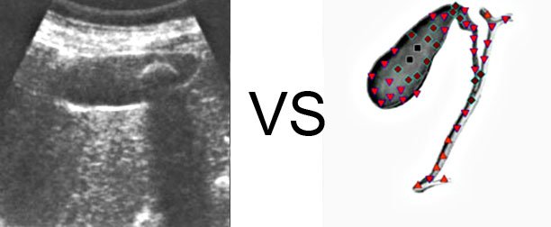Biorezonans Pyskowice 