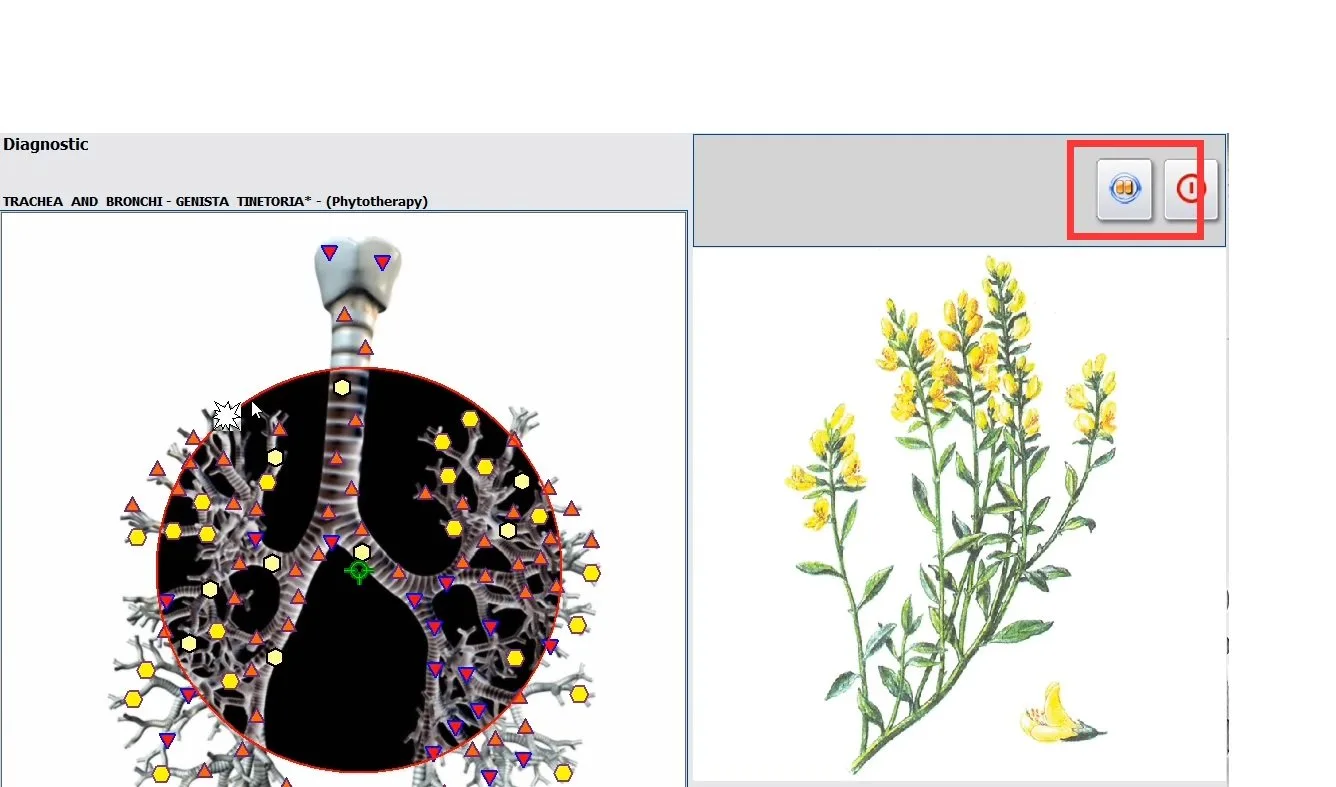 Urządzenie do biorezonansu NLS — praktyczna odpowiedź dla centrów szkoleniowych w Polsce — MAIKONG Hunter 4025 Metatron (1330).jpg